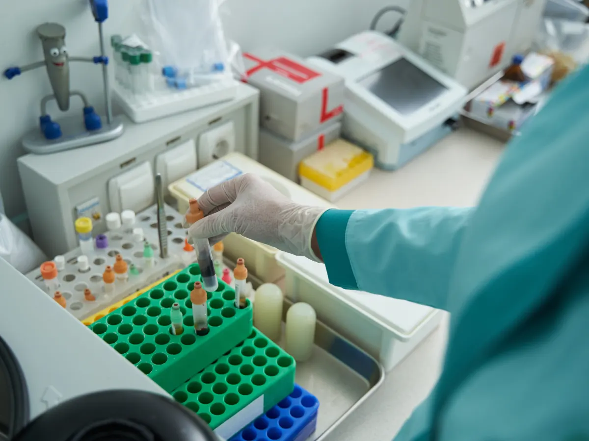 Muestras de laboratorio para análisis clínicos corporativos
