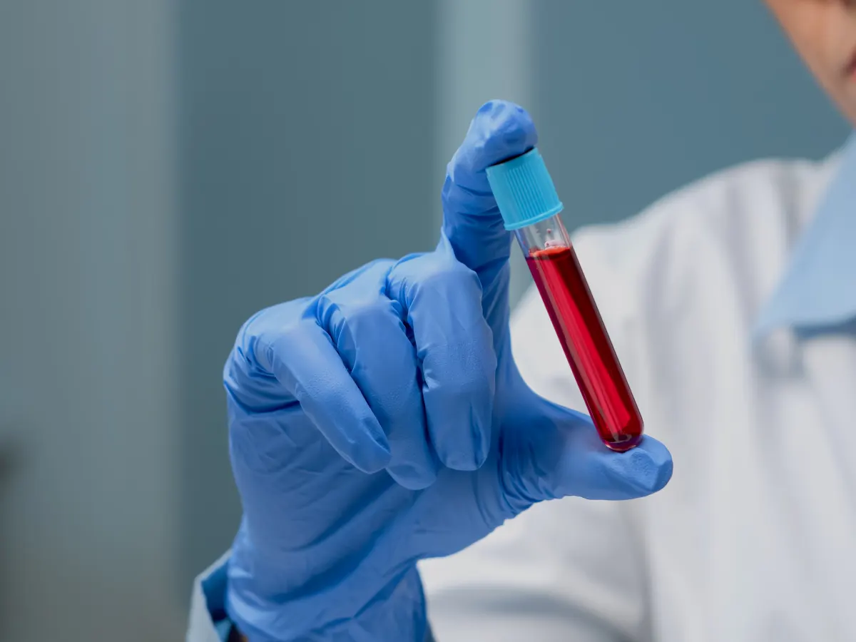 Muestra de sangre preparada para un análisis clínico